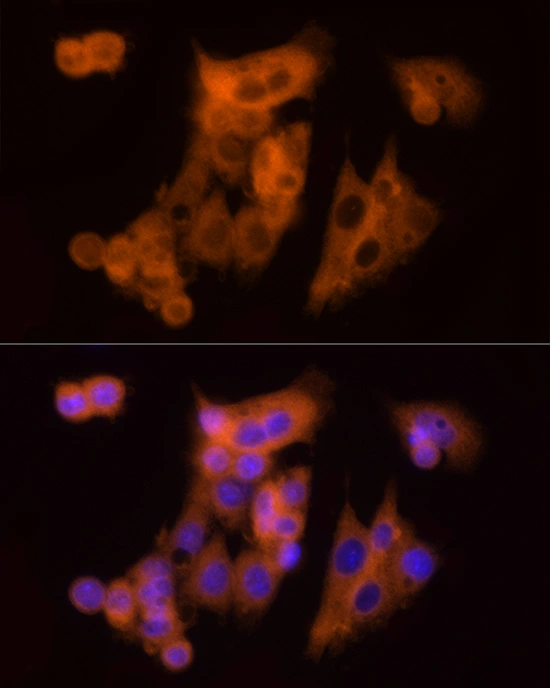 ICC/IF analysis of HepG2 cells using GTX65866 CLIC1 antibody. Red: Primary antibody Blue : DAPI Dilution : 1:100 ICC/IF analysis of HepG2 cells using GTX65866 CLIC1 antibody. Red: Primary antibody Blue : DAPI Dilution : 1:100