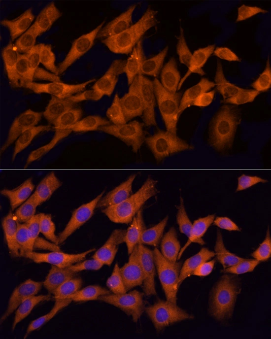 ICC/IF analysis of PC12 cells using GTX65866 CLIC1 antibody. Red: Primary antibody Blue : DAPI Dilution : 1:100 ICC/IF analysis of PC12 cells using GTX65866 CLIC1 antibody. Red: Primary antibody Blue : DAPI Dilution : 1:100