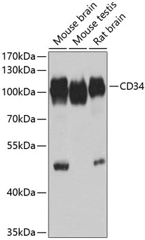 WB analysis of various sample lysates using GTX65867 CD34 antibody. Dilution : 1:1000 Loading : 25microg per lane