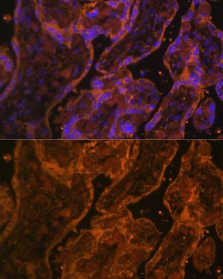 IHC-P analysis of human placenta tissue using GTX65867 CD34 antibody. Blue : DAPI Dilution : 1:100