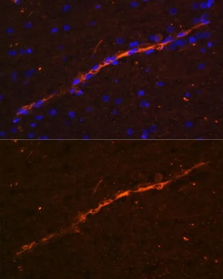 IHC-P analysis of rat brain tissue using GTX65867 CD34 antibody. Blue : DAPI Dilution : 1:100