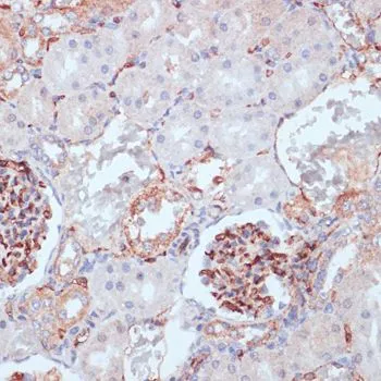 IHC-P analysis of rat kidney tissue using GTX65867 CD34 antibody. Dilution : 1:100