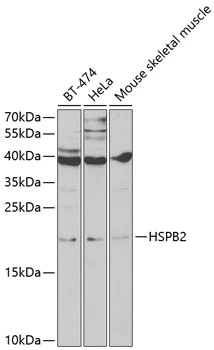 WB analysis of various sample lysates using GTX65869 HSPB2 antibody. Dilution : 1:1000 Loading : 25microg per lane WB analysis of various sample lysates using GTX65869 HSPB2 antibody. Dilution : 1:1000 Loading : 25microg per lane