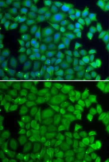 ICC/IF analysis of U2OS cells using GTX65869 HSPB2 antibody. Blue : DAPI