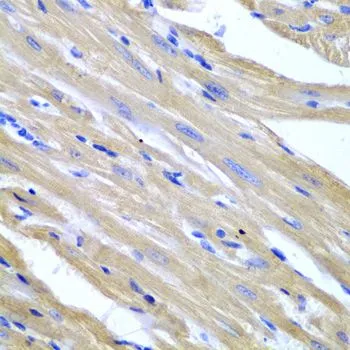 IHC-P analysis of mouse heart tissue using GTX65869 HSPB2 antibody. Dilution : 1:200