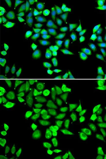 ICC/IF analysis of A549 cells using GTX65871 Apc6 antibody. Blue : DAPI