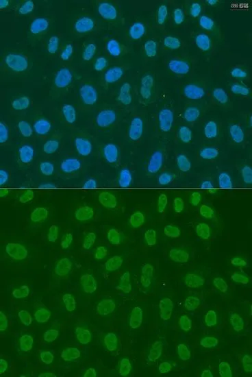 ICC/IF analysis of U2OS cells using GTX65872 LSM2 antibody. Blue : DAPI Dilution : 1:100
