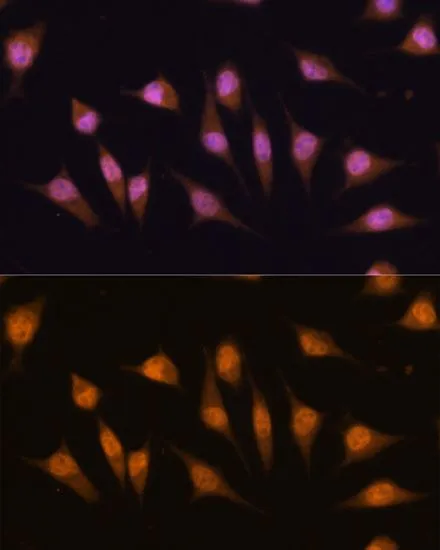 ICC/IF analysis of L929 cells using GTX65875 MyoD1 antibody. Blue : DAPI Dilution : 1:100