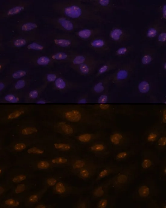 ICC/IF analysis of C6 cells using GTX65875 MyoD1 antibody. Blue : DAPI Dilution : 1:100
