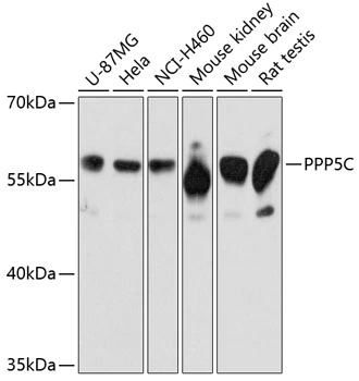 WB analysis of various sample lysates using GTX65877 PPP5C antibody. Dilution : 1:3000 Loading : 25microg per lane WB analysis of various sample lysates using GTX65877 PPP5C antibody. Dilution : 1:3000 Loading : 25microg per lane
