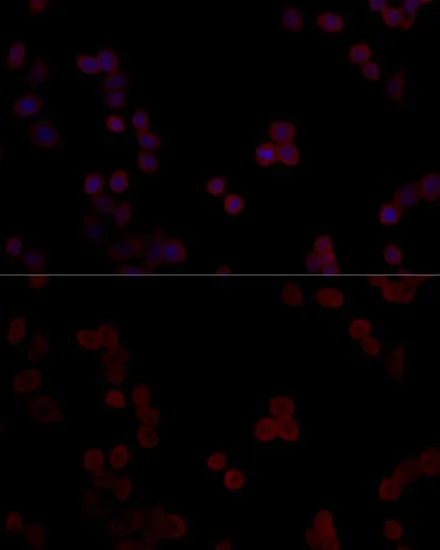 ICC/IF analysis of HeLa cells using GTX65877 PPP5C antibody. Blue : DAPI Dilution : 1:100