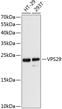 WB analysis of various sample lysates using GTX65880 VPS29 antibody. Dilution : 1:3000 Loading : 25microg per lane WB analysis of various sample lysates using GTX65880 VPS29 antibody. Dilution : 1:3000 Loading : 25microg per lane