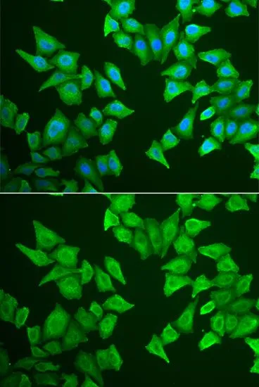 ICC/IF analysis of HeLa cells using GTX65890 ALAS-E antibody. Blue : DAPI