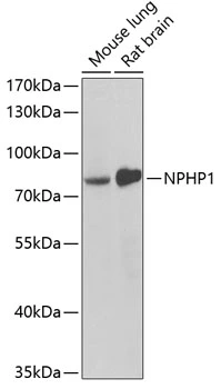 WB analysis of various sample lysates using GTX65891 NPHP1 antibody. Dilution : 1:1000 Loading : 25microg per lane WB analysis of various sample lysates using GTX65891 NPHP1 antibody. Dilution : 1:1000 Loading : 25microg per lane