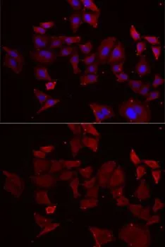 ICC/IF analysis of MCF7 cells using GTX65891 NPHP1 antibody. Blue : DAPI