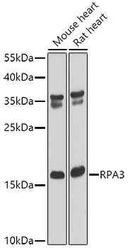 WB analysis of various sample lysates using GTX65893 RPA14 antibody. Dilution : 1:1000 Loading : 25microg per lane WB analysis of various sample lysates using GTX65893 RPA14 antibody. Dilution : 1:1000 Loading : 25microg per lane
