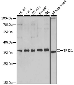 WB analysis of various sample lysates using GTX65894 TREX1 antibody. The signal was developed with ECL plus-Enhanced. Dilution : 1:1000 Loading : 25microg per lane WB analysis of various sample lysates using GTX65894 TREX1 antibody. The signal was developed with ECL plus-Enhanced. Dilution : 1:1000 Loading : 25microg per lane