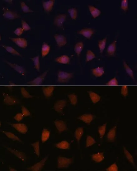 ICC/IF analysis of L929 cells using GTX65894 TREX1 antibody. Blue : DAPI Dilution : 1:100