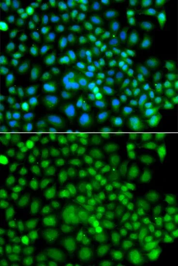 ICC/IF analysis of A549 cells using GTX65895 SUMO4 antibody. Blue : DAPI