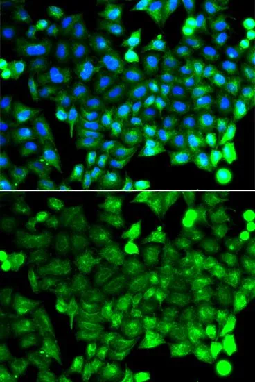 ICC/IF analysis of A549 cells using GTX65899 NCALD antibody. Blue : DAPI