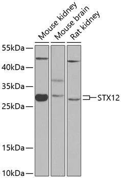WB analysis of various sample lysates using GTX65901 STX12 antibody. Dilution : 1:1000 Loading : 25microg per lane WB analysis of various sample lysates using GTX65901 STX12 antibody. Dilution : 1:1000 Loading : 25microg per lane