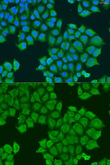 ICC/IF analysis of U2OS cells using GTX65901 STX12 antibody. Blue : DAPI Dilution : 1:100