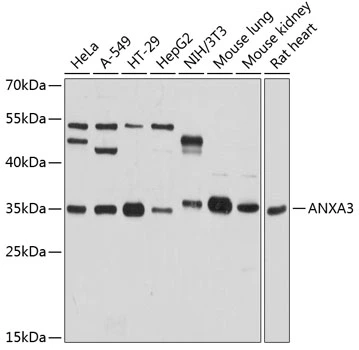 WB analysis of various sample lysates using GTX65903 Annexin III antibody. Dilution : 1:3000 Loading : 25microg per lane