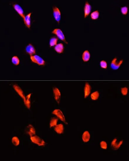 ICC/IF analysis of HeLa cells using GTX65903 Annexin III antibody. Blue : DAPI Dilution : 1:100