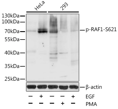 WB analysis of HeLa cells treated by EGF (100ng/mL) for 30 minutes after serum-starvation overnight using GTX65906 Raf1 (phospho Ser621) antibody. Dilution : 1:1000 Loading : 25microg per lane