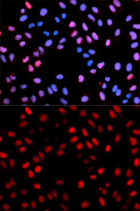 ICC/IF analysis of U2OS cells using GTX65906 Raf1 (phospho Ser621) antibody. Blue : DAPI