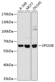 WB analysis of various sample lysates using GTX65908 VPS33B antibody. Dilution : 1:1000 Loading : 25microg per lane WB analysis of various sample lysates using GTX65908 VPS33B antibody. Dilution : 1:1000 Loading : 25microg per lane
