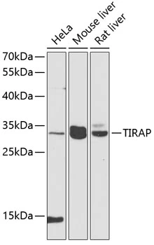 WB analysis of various sample lysates using GTX65910 TIRAP antibody. Dilution : 1:1000 Loading : 25microg per lane WB analysis of various sample lysates using GTX65910 TIRAP antibody. Dilution : 1:1000 Loading : 25microg per lane