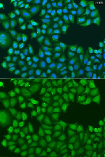 ICC/IF analysis of U2OS cells using GTX65910 TIRAP antibody. Blue : DAPI Dilution : 1:100