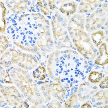 IHC-P analysis of mouse kidney tissue using GTX65910 TIRAP antibody. Dilution : 1:100