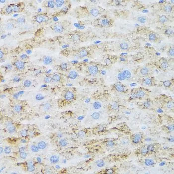 IHC-P analysis of mouse liver tissue using GTX65910 TIRAP antibody. Dilution : 1:100