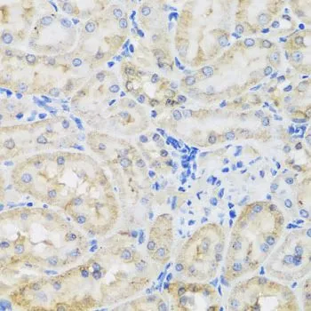 IHC-P analysis of rat kidney tissue using GTX65910 TIRAP antibody. Dilution : 1:100