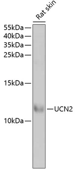WB analysis of rat skin tissue lysate using GTX65915 Urocotin 2 antibody. Dilution : 1:1000 Loading : 25microg per lane WB analysis of rat skin tissue lysate using GTX65915 Urocotin 2 antibody. Dilution : 1:1000 Loading : 25microg per lane