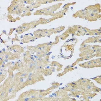 IHC-P analysis of mouse heart tissue using GTX65915 Urocotin 2 antibody. Dilution : 1:100