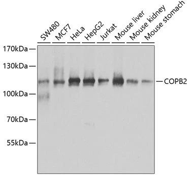 WB analysis of various sample lysates using GTX65917 COPB2 antibody. Dilution : 1:1000 Loading : 25microg per lane WB analysis of various sample lysates using GTX65917 COPB2 antibody. Dilution : 1:1000 Loading : 25microg per lane