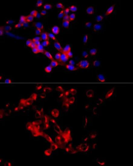 ICC/IF analysis of NIH/3T3 cells using GTX65917 COPB2 antibody. Blue : DAPI Dilution : 1:100