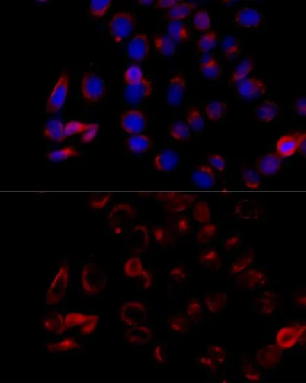 ICC/IF analysis of HeLa cells using GTX65917 COPB2 antibody. Blue : DAPI Dilution : 1:100