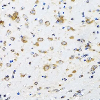 IHC-P analysis of mouse brain tissue using GTX65917 COPB2 antibody. Dilution : 1:100