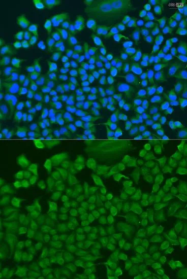 ICC/IF analysis of U2OS cells using GTX65921 HS1BP3 antibody. Blue : DAPI Dilution : 1:100