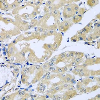 IHC-P analysis of human stomach tissue using GTX65921 HS1BP3 antibody. Dilution : 1:100