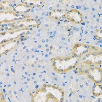 IHC-P analysis of rat kidney tissue using GTX65921 HS1BP3 antibody. Dilution : 1:100
