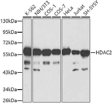 WB analysis of various sample lysates using GTX65924 HDAC2 antibody. Dilution : 1:1000 Loading : 25microg per lane