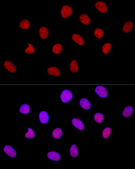ICC/IF analysis of U2OS cells using GTX65926 CTCF antibody. Blue : DAPI Dilution : 1:100