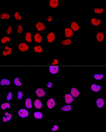 ICC/IF analysis of HeLa cells using GTX65926 CTCF antibody. Blue : DAPI Dilution : 1:100