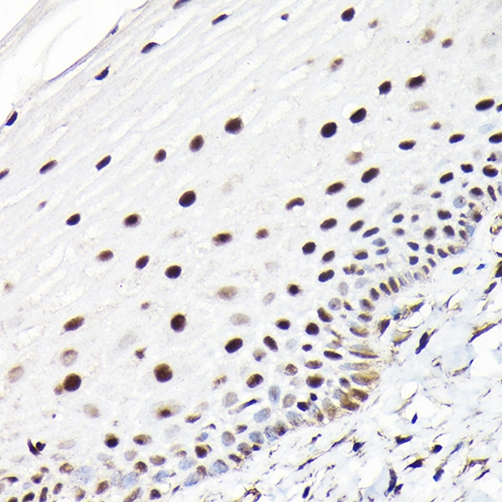 IHC-P analysis of human normal cervix tissue using GTX65926 CTCF antibody. Antigen retrieval : 0.01M Citrate Buffer, pH 6.0 Dilution : 1:100