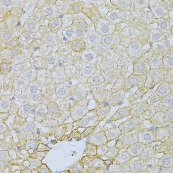 IHC-P analysis of rat liver tissue using GTX65929 PLA2R1 antibody. Dilution : 1:100